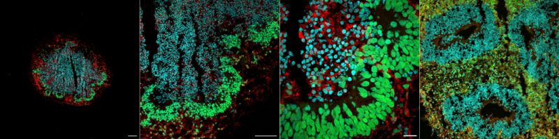 Midbrain and cerebral organoids